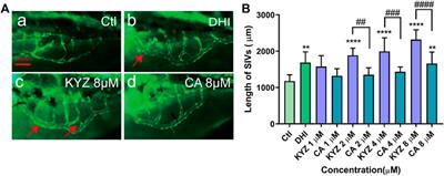 Promoting Angiogenesis Effect and Molecular Mechanism of Isopropyl Caffeate (KYZ), a Novel Metabolism-Derived Candidate Drug, Based on Integrated Network Pharmacology and Transgenic Zebrafish Models